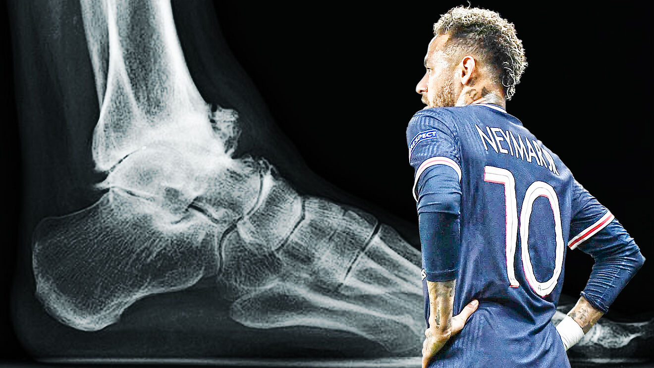 Từ khi gia nhập PSG, Neymar đã phải nghỉ bao nhiêu trận đấu?
